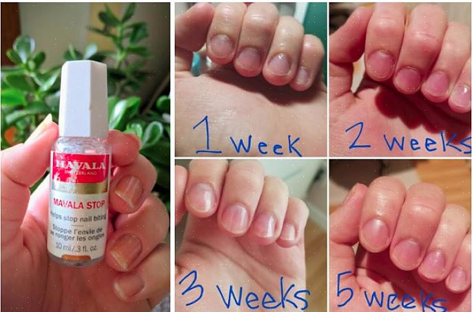 Recomendo fortemente pegar uma cópia de Pare de roer as unhas - este guia popular tem dicas comprovadas