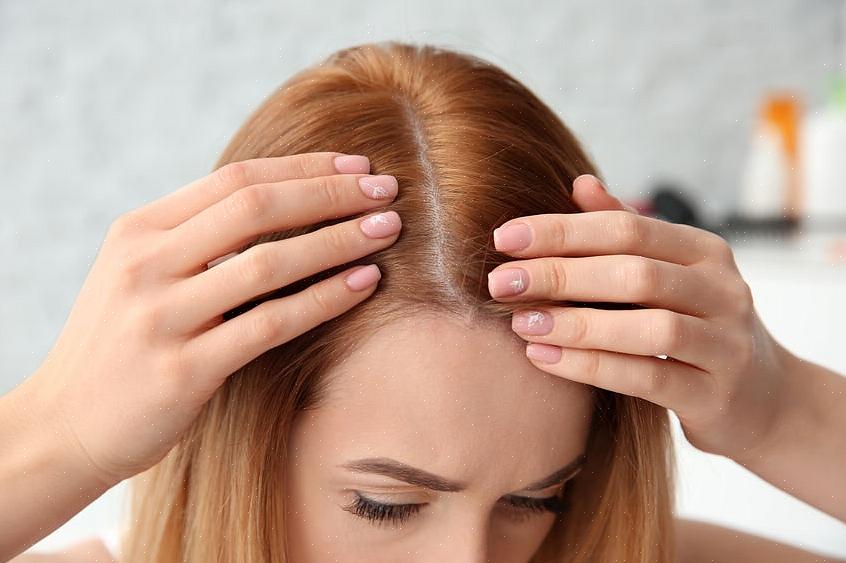 A maioria das mulheres com queda de cabelo de padrão feminino a experimenta após a menopausa