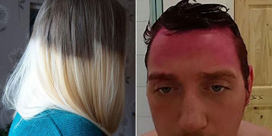 A boa notícia é que existem muitas maneiras de remediar uma má coloração de cabelo