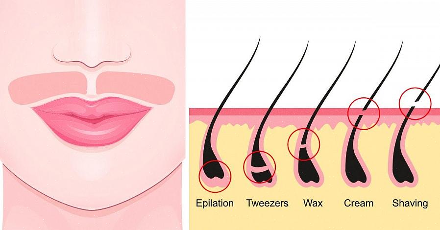 O que você pode fazer para minimizar o processo doloroso de depilação é retardar o crescimento
