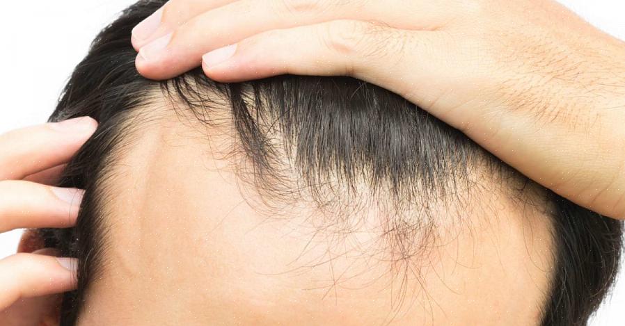 Outras fontes de vitamina E ajudam a contribuir para um melhor crescimento do cabelo