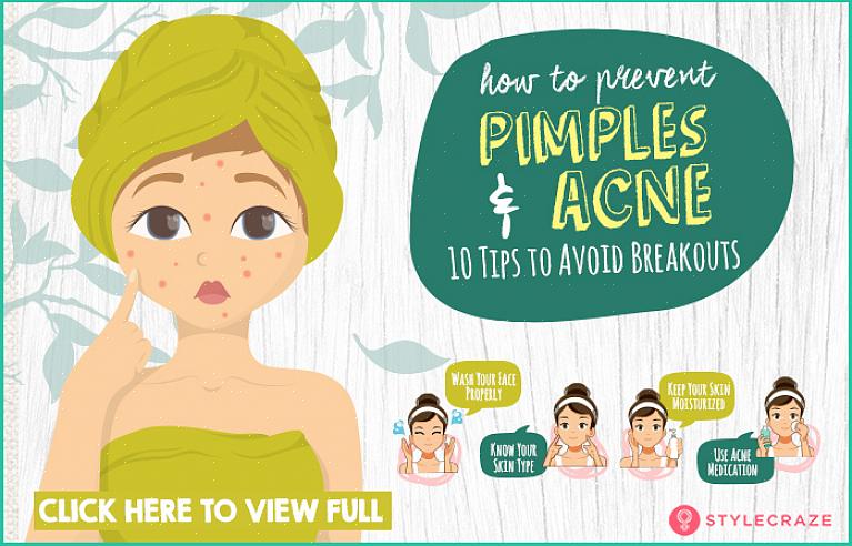 É fácil evitar a acne