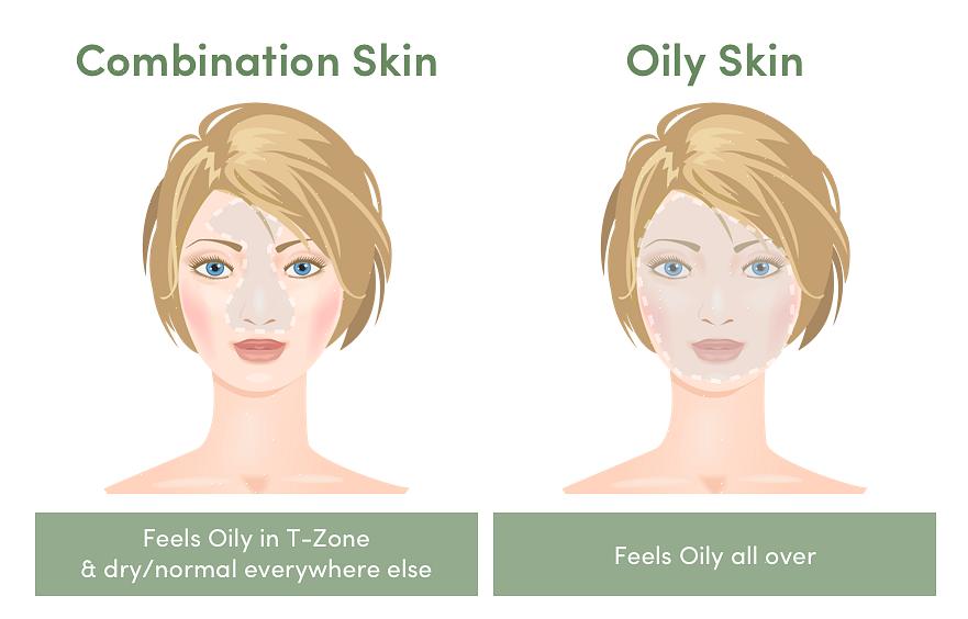 Os especialistas notaram que a pele de indivíduos com pele oleosa envelhece mais lentamente em comparação