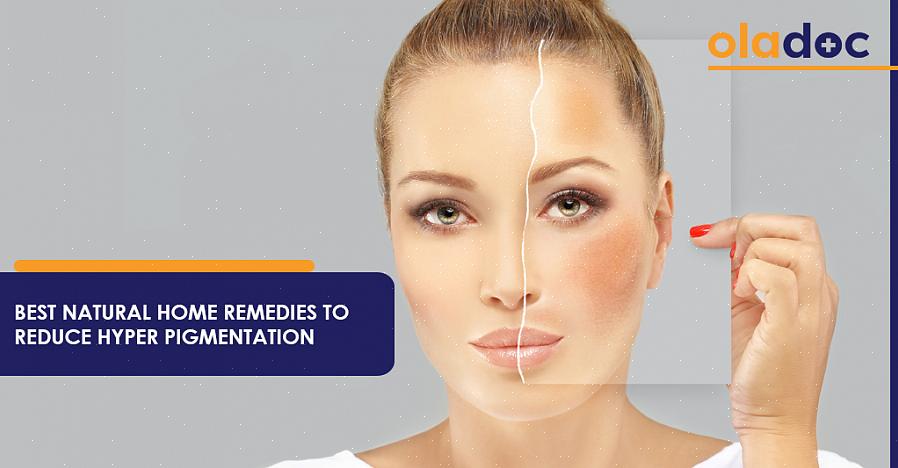 A hiperpigmentação é uma condição da pele caracterizada pelo escurecimento de algumas manchas
