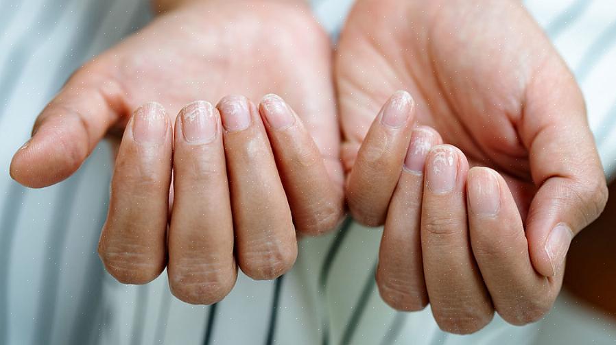 Isso diminuirá a necessidade de usar um removedor de esmalte