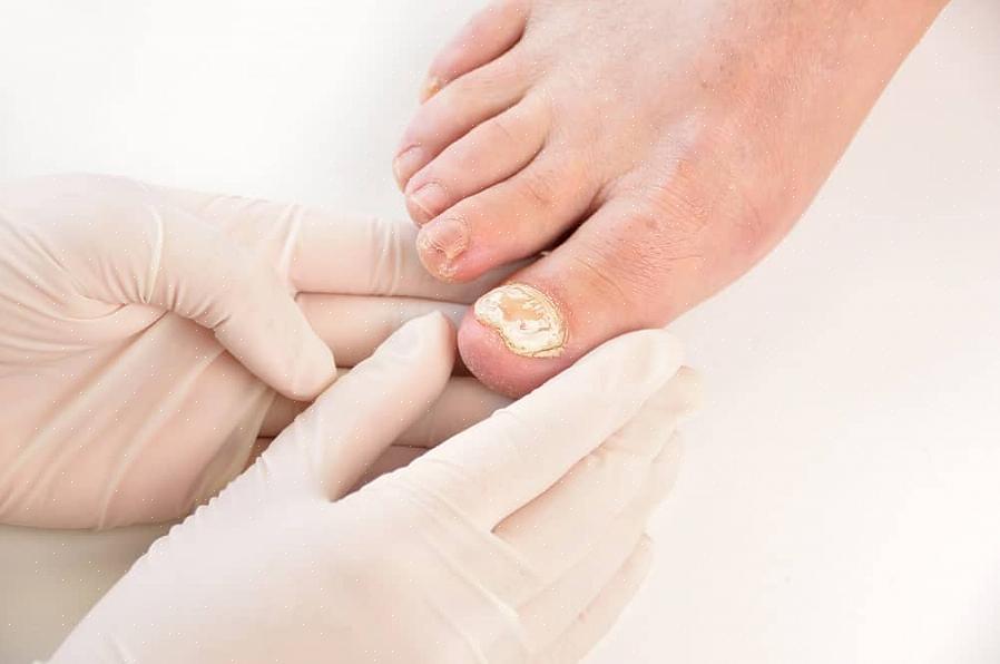 Para começar a fazer pedicure