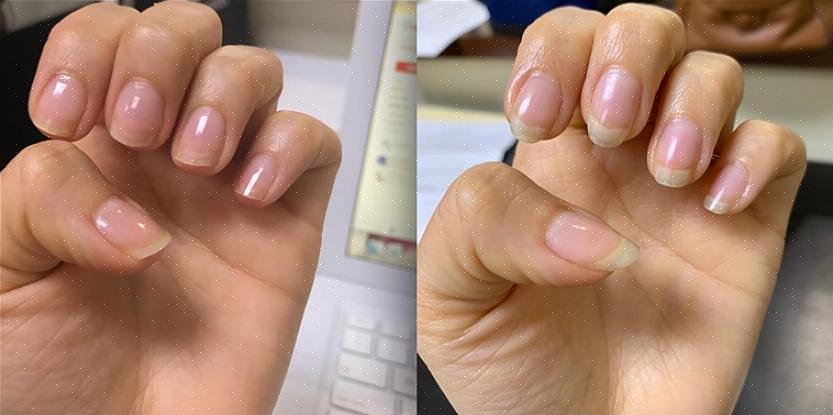 Cuidar das unhas não começa