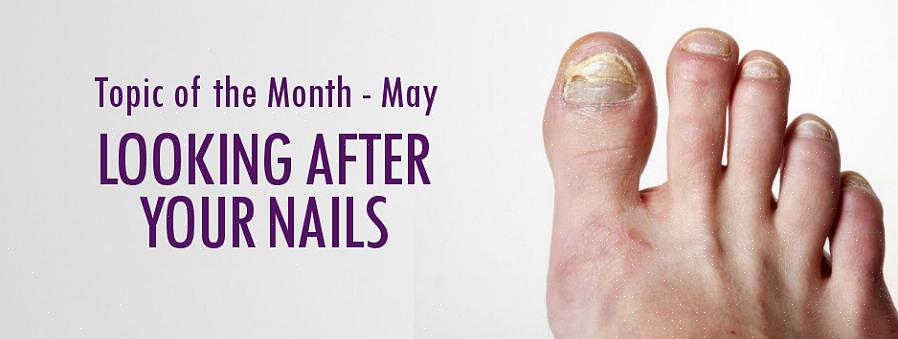 A boa notícia é que você pode remover as estrias feias das unhas das unhas dos pés