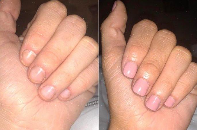 Essas atividades podem criar arestas ao redor das unhas