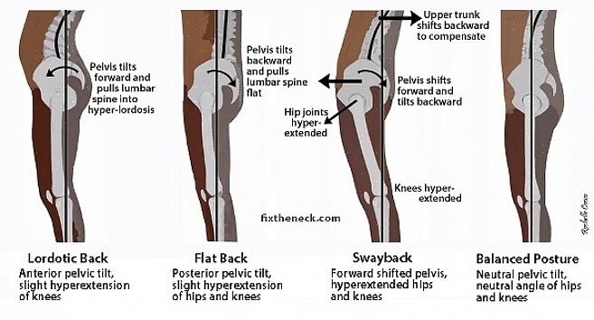 Os movimentos físicos por meio de exercícios também podem tratar os joelhos lesionados