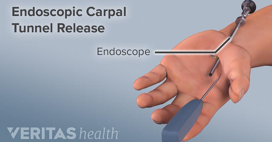 Após a cirurgia