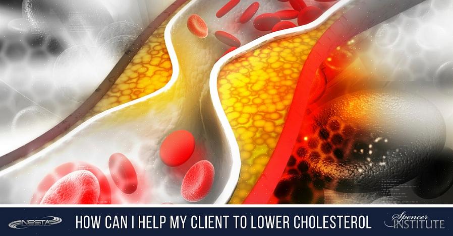 Aqui estão várias maneiras de reduzir seus níveis de colesterol