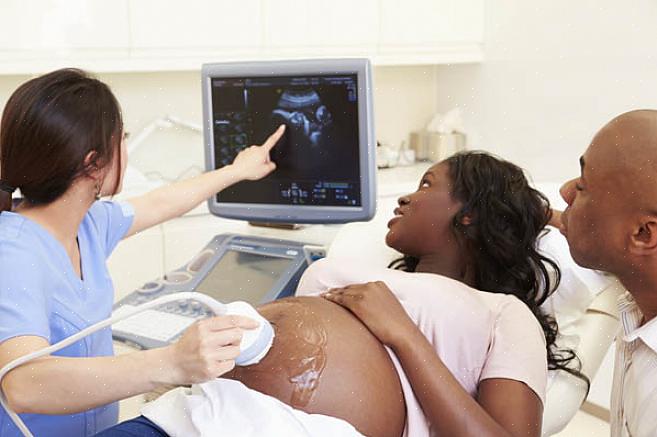 Devido ao fato de que a indústria de ultrassonografia médica é relativamente nova
