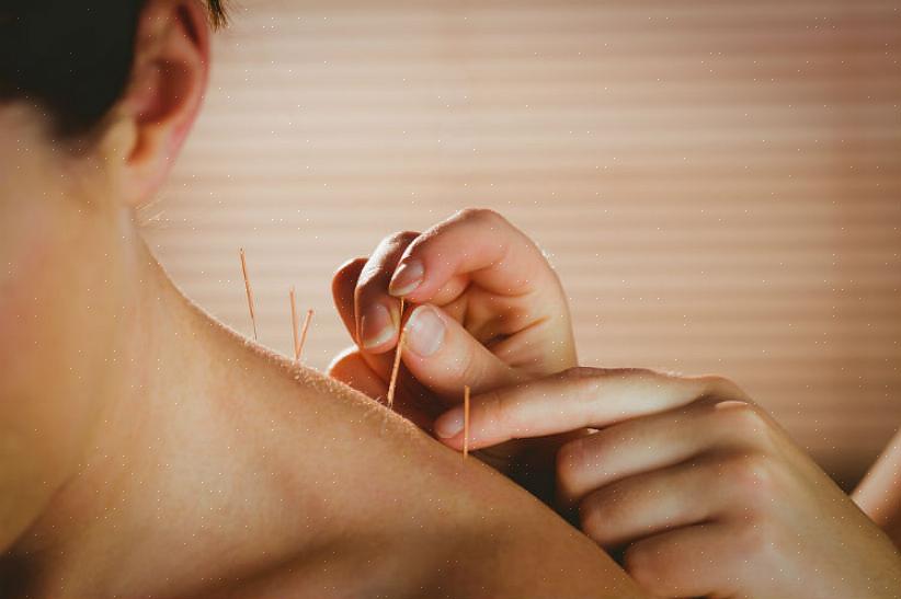 Ganhe um diploma de acupuntura em uma escola de acupuntura respeitável